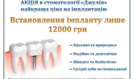 Стоматологія «Джулія» пропонує імплантацію за 12000 грн